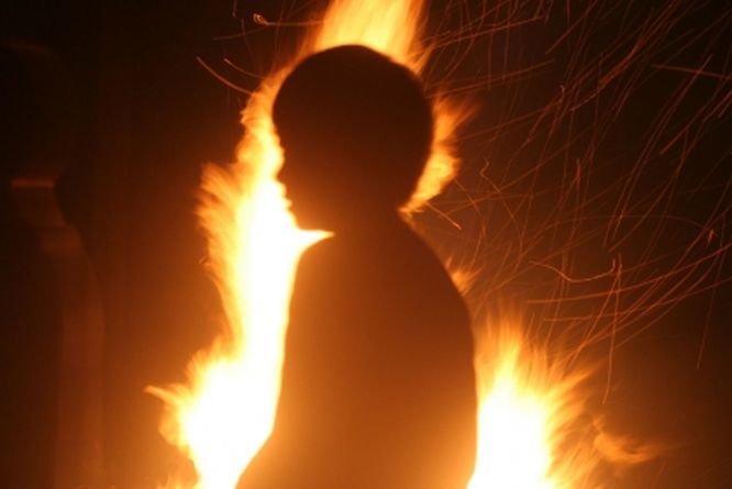 Мальчика, получившего ожоги в гараже в Кстове, могли поджечь - фото 1